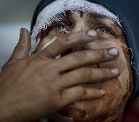 10 фотоисторий о силе человеческой воли