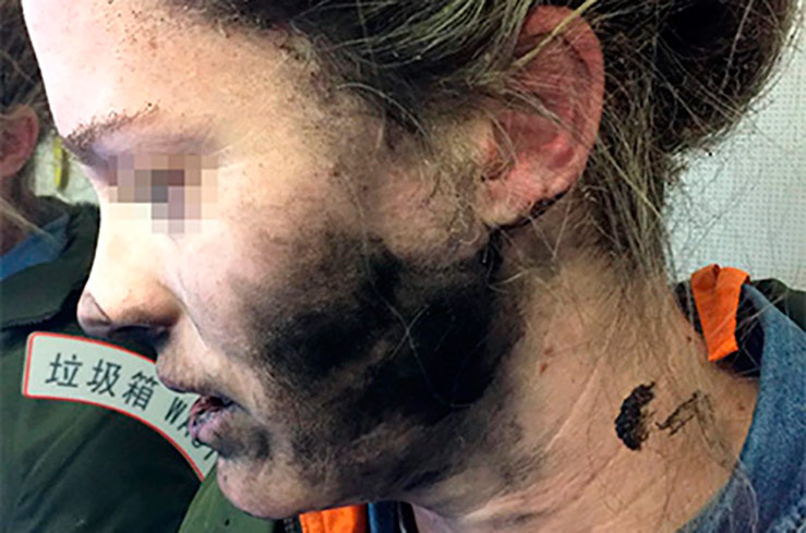 У пассажирки рейса в Австралию прямо на голове взорвались наушники У пассажирки рейса в Австралию прямо на голове взорвались наушники